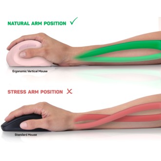 Connect IT For Health Ergonomická vertikální bezdrátová myš (+1x AA baterie) - růžová